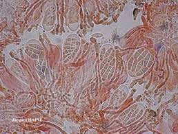 Attēlu rezultāti vaicājumam “Cliostomum corrugatum”