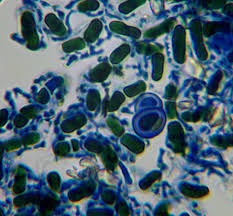Attēlu rezultāti vaicājumam “Chaenotheca stemonea”
