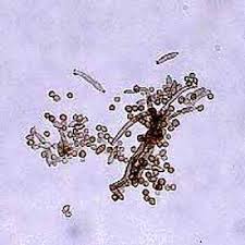 Attēlu rezultāti vaicājumam “Diderma subviridifuscum spores”