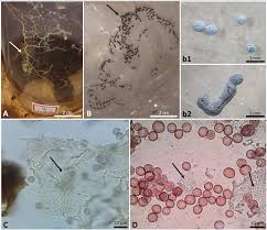 Attēlu rezultāti vaicājumam “Perichaena corticalis sessile”