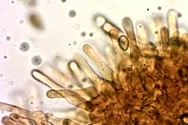 Attēlu rezultāti vaicājumam “Trichia alpina macro”