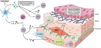 Image result for GCA