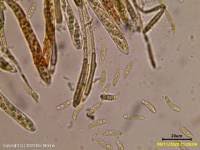 Attēlu rezultāti vaicājumam “Chlorencoelia versiformis”