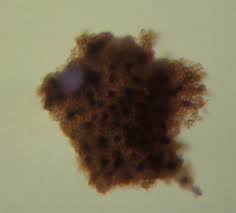 Attēlu rezultāti vaicājumam “Badhamiopsis ainoae spores”