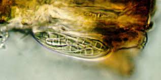 Attēlu rezultāti vaicājumam “Opegrapha atra”