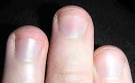 File:Fingernails.jpg - Wikipedia, the free encyclopedia