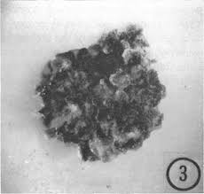 Attēlu rezultāti vaicājumam “Blasia pusilla sporophyte”