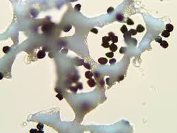 Attēlu rezultāti vaicājumam “Badhamia capsulifera var. arborea spores”