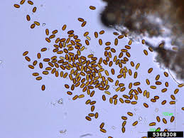 Attēlu rezultāti vaicājumam “Diachea muscorum spores”