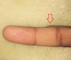 Znalezione obrazy dla zapytania palec