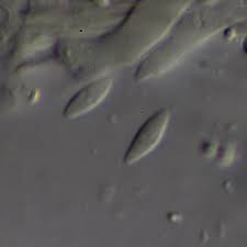 Attēlu rezultāti vaicājumam “Hyalorbilia inflatula”