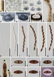 Attēlu rezultāti vaicājumam “Rosellinia desmazieri spores”