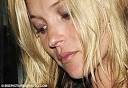 on model Kate's nose