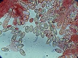 Attēlu rezultāti vaicājumam “Crepidotus versutus”