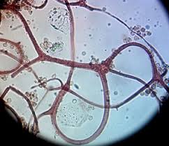 Attēlu rezultāti vaicājumam “Cribraria rubiginosa”