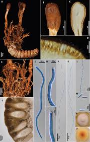 Attēlu rezultāti vaicājumam “Heterotrichia insignis (syn. Arcyria insignis) spores”