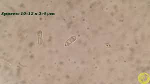 Attēlu rezultāti vaicājumam “Calocera glossoides”