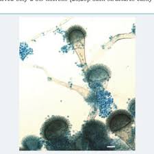 Attēlu rezultāti vaicājumam “Ophiostoma polyporicola”