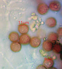 Attēlu rezultāti vaicājumam “Diderma ochraceum young”