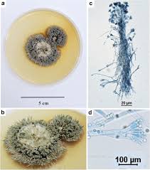 Attēlu rezultāti vaicājumam “Penicillium vulpinum”