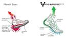Viva la Vivo! Barefoot form meets high style. | Running Quest