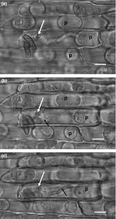 Attēlu rezultāti vaicājumam “Dianema depressum spores”