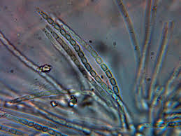 Attēlu rezultāti vaicājumam “Hypocrea pulvinata”