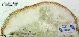 Attēlu rezultāti vaicājumam “Trapeliopsis flexuosa”