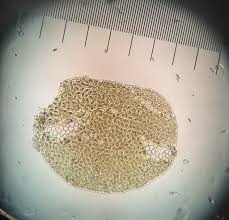 Attēlu rezultāti vaicājumam “Radula complanata”