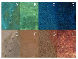 Attēlu rezultāti vaicājumam “Badhamia utricularis plasmodium”