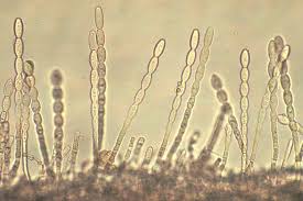 Attēlu rezultāti vaicājumam “Badhamia affinis var. microspora macro”