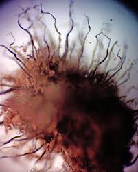 Attēlu rezultāti vaicājumam “Symphytocarpus impexus spores”