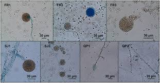 Attēlu rezultāti vaicājumam “Badhamia affinis var. microspora spores”