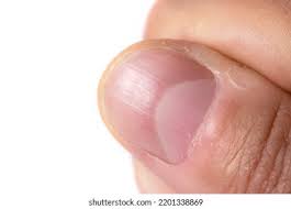 Image result for lunula nail