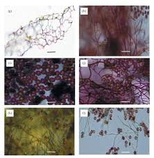 Attēlu rezultāti vaicājumam “Physarum, Nannengaella sp.”