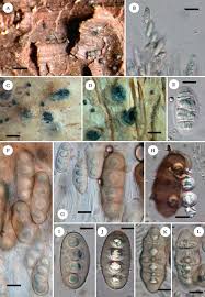 Attēlu rezultāti vaicājumam “Perichaena corticalis spores”