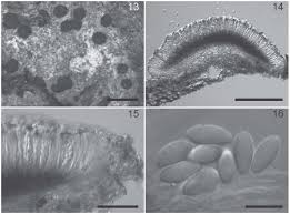 Attēlu rezultāti vaicājumam “Hertelidea botryosa”