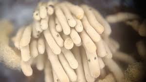 Attēlu rezultāti vaicājumam “Heterotrichia oerstedii (syn. Arcyria oerstedii) spores”