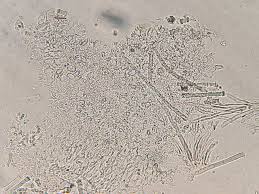 Attēlu rezultāti vaicājumam “Lachnella alboviolascens”