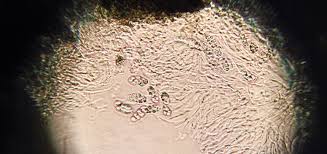 Attēlu rezultāti vaicājumam “Nostoc pruniforme macro”