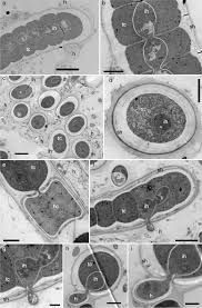 Attēlu rezultāti vaicājumam “Athelia pyriformis”