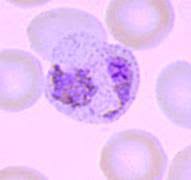 Attēlu rezultāti vaicājumam “Siphoptychium violaceum plasmodium”