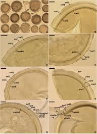 Attēlu rezultāti vaicājumam “Enteridium variabile spores”