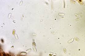 Attēlu rezultāti vaicājumam “Lycogala asperum macro”