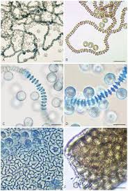 Attēlu rezultāti vaicājumam “Arcyria minuta stalked”