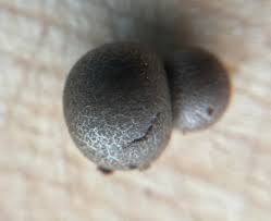 Attēlu rezultāti vaicājumam “Lycogala flavofuscum sessile”