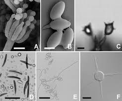 Attēlu rezultāti vaicājumam “Physarum obscurum spores”