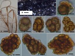 Attēlu rezultāti vaicājumam “Urocystis anemones spores”