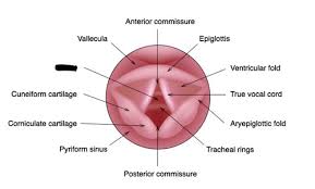 Attēlu rezultāti vaicājumam “Cribraria piriformis young”