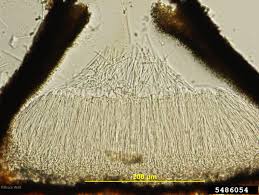 Attēlu rezultāti vaicājumam “Rhytisma acerinum”